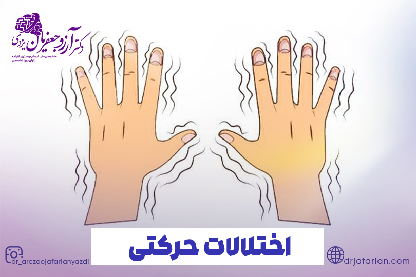 درمان اختلالات حرکتی