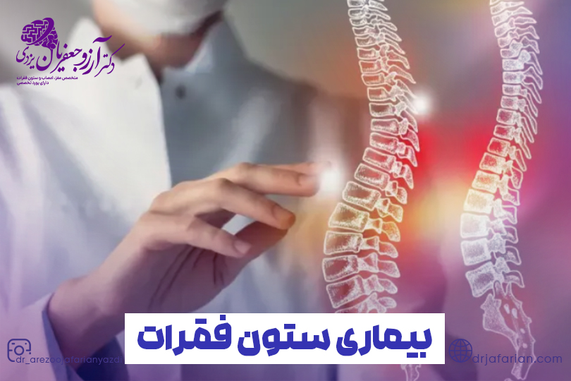 درمان بیماری های ستون فقرات