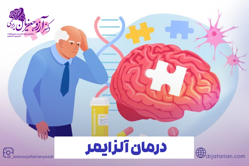 درمان آلزایمر