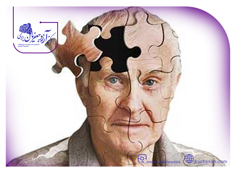 علائم آلزایمر