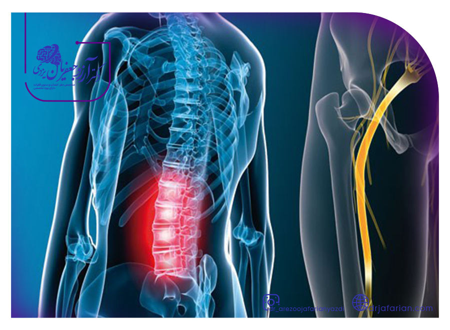 تشخیص اختلالات عصبی عضلانی