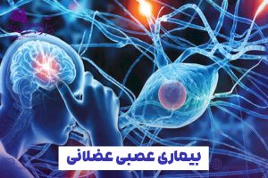 درمان بیماری های عصبی عضلانی