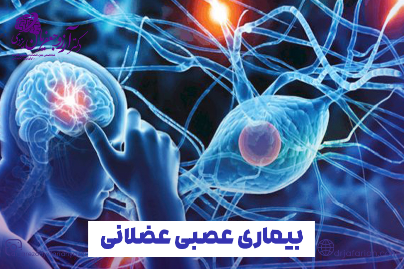 درمان بیماری های عصبی عضلانی