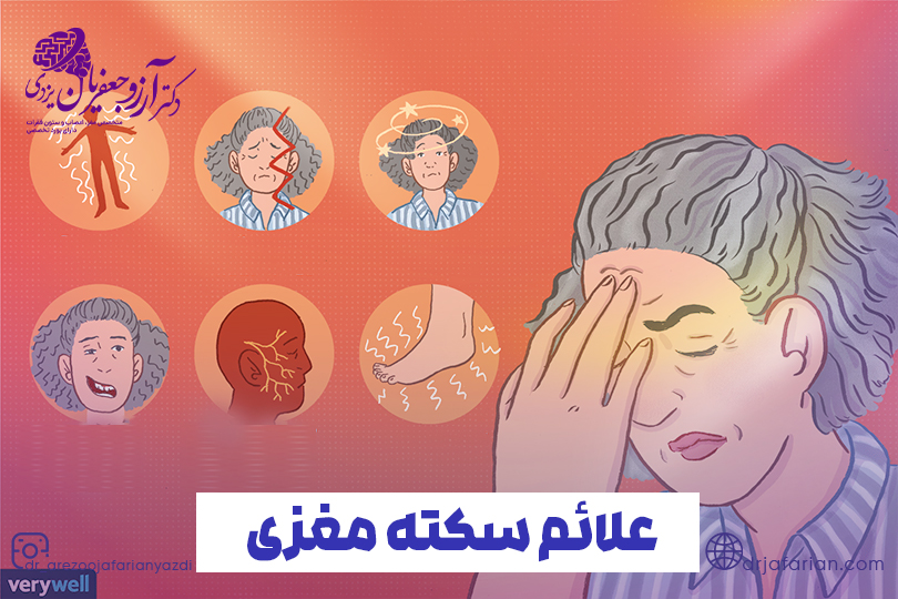 علائم سکته مغزی