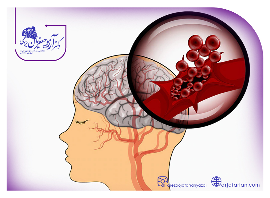 نشانه های بیماری هموراژیک